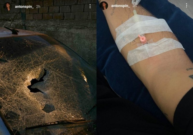Galleria foto - Antonino Spinalbese vittima di un incidente: la reazione di Belen su Instagram Foto 3