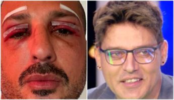 Fabrizio Corona sui social dopo la chirurgia: l’intervento e l’attacco a Gabriel Garko